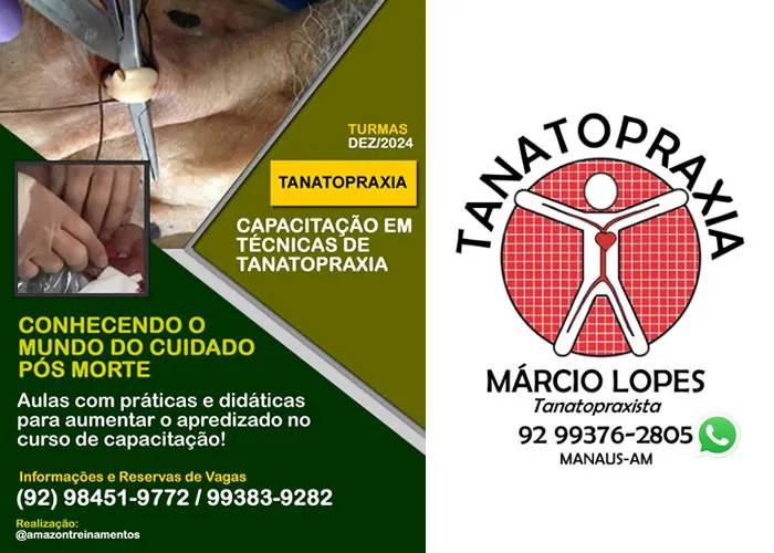 Você já pensou em atuar em uma área essencial e de grande importância no setor funerário? 

Venha se especializar no Curso de Tanatopraxia, onde você aprenderá os principais procedimentos de conservação e preparo do corpo após o falecimento.

Sob a instrução de um profissional referência em Manaus, com vasta experiência na área, você terá a oportunidade de desenvolver habilidades práticas e teóricas necessárias para uma atuação qualificada e respeitosa no mercado.

O que você aprenderá:

Técnicas de conservação corporal
Processos de higienização e embelezamento
Normas sanitárias e éticas
Preparo adequado para velórios e cerimônias
Participe e esteja pronto para integrar um dos setores mais nobres do cuidado póstumo!

Vagas limitadas – Garanta já a sua inscrição!

&#128197; Data de início: DEZ/2024 

Local: 	&#128205; Endereço: R. Visc. de Pôrto Seguro, 864 - Parque das Flores, Manaus - AM, 69054-794 

✉️ Inscrições e mais informações:

&#128222; (92) 98451-9772 e 99383-9282

A TANATOPRAXIA é o procedimento de conservação do corpo após o seu falecimento. Esse procedimento tem como principal objetivo retardar o processo de decomposição natural do corpo por meio de higienização e aplicação de produtos químicos, preparação e ação que é realizada em clínicas de preparação de cadáveres e tornou-se serviço básico em todas as funerárias.

Público-alvo para a Capacitação:

Público em geral que tenham interesse no assunto;
Pessoas que buscam uma nova oportunidade de trabalho;
Estudantes da área da saúde que tem horas complementares para cumprir.

Pré-requesito: 

18 anos de idade.
, Egípcia Funerária , Amazontreinamentos e Márcio Lopes, em, Brasil