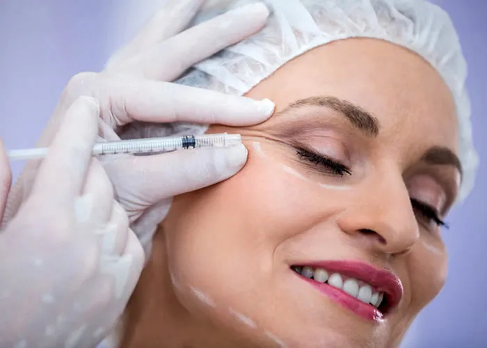 O ácido hialurônico é uma substância natural encontrada no corpo humano e na pele. É um componente essencial da matriz intercelular, e sua presença ajuda a manter a elasticidade e a estrutura de vários órgãos e tecidos do corpo. Além disso, o ácido hialurônico está presente no nariz e nos olhos dos humanos, nas lágrimas e na cartilagem das articulações das pessoas. Além de apoiar a estrutura de nossos corpos, o ácido hialurônico tem propriedades terapêuticas para o corpo humano de várias maneiras.

A maior parte do ácido hialurônico encontrado no corpo está no sistema nervoso central, coração, articulações, olhos e músculos. Como é um composto de proteína A que entra em suas células, ele pode permanecer em sua pele por vários anos. O poder do ácido hialurônico pode ser visto na das pessoas. Pessoas com altos níveis de ácido hialurônico tendem a ser mais fortes e resistentes do que aquelas com níveis mais baixos. Além disso, pessoas com altos níveis de ácido hialurônico tendem a ser mais saudáveis do que aqueles com baixos níveis. Por exemplo, pessoas com altos níveis de ácido hialurônico têm pele mais espessa e são menos suscetíveis a temperaturas frias do que aqueles com baixos níveis de ácido hialurônico. 

Ácido hialurônico protege tecidos e órgãos de doenças, envelhecimento e lesões. Além disso, o ácido hialurônico, promove a regeneração dos tecidos e mantém as condições saudáveis da pele, promovendo a retenção de água na camada derme da pele. Também promove a saúde das articulações ao apoiar a formação da cartilagem, um processo que auxilia o movimento das articulações. Além disso, o ácido hialurônico, promove a formação e o crescimento de novos tecidos, promovendo o fluxo sanguíneo e garantindo a nutrição adequada das células. A presença de ácido hialurônico, em nossos corpos nos mantém saudáveis, promovendo processos de cura cruciais para nosso bem-estar.
 
A presença de ácido hialurônico é essencial para preservar a saúde, bem como a saúde humana. No entanto, o ácido hialurônico pode ser contaminado quando interagimos com animais ou plantas sem mãos ou unhas limpas. A contaminação ocorre quando pequenas quantidades de ácido hialurônico dérmico entram na pele ou nos folículos capilares por meio do contato direto com a pele humana ou folículos capilares. Com o tempo, o crescimento bacteriano pode ocorrer se você não limpar a pele bem o suficiente. Quando isso acontece, o ácido hialurônico não pode mais proteger sua saúde,  pode realmente prejudicá-lo se for muito contaminado por bactérias.

Nossos corpos consistem em vários tipos de fontes animais e vegetais, se formos humanos ou animais com altos níveis de ácido hialurônico. Ácido hialurônico mantém estruturas saudáveis, como visão, dentes, cabelo e pele. Portanto, manter níveis ótimos de ácido hialurônico natural é essencial para nos manter saudáveis nutricionalmente e fisicamente.

 Qualquer um pode aplicar níveis ótimos de ácido hialurônico lavando bem e evitando a contaminação de forma eficaz o suficiente para se manter saudável.
, Topsaudeebeleza, Hialuroni Caps e Combate Rugas e Bigode, em, Brasil
