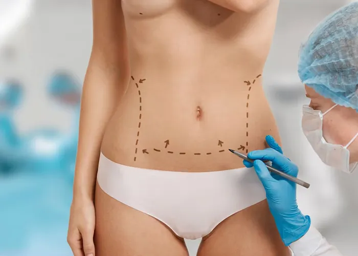 O presente estudo investigou os efeitos da cirurgia plástica na autoestima e na imagem corporal.  Os participantes podem ter internalizado os ideais de beleza retratados pelas mulheres em imagens, tornando-os mais propensos a considerar a cirurgia plástica.  Os resultados mostraram que as pessoas que se submeteram à cirurgia estética tinham maior auto-estima sexual, estavam mais satisfeitas com sua imagem corporal e experimentavam mais bem-estar. , Clínica para Criolipólise, Criolipólise advanced e Clinicas de harmonização, em, Brasil
