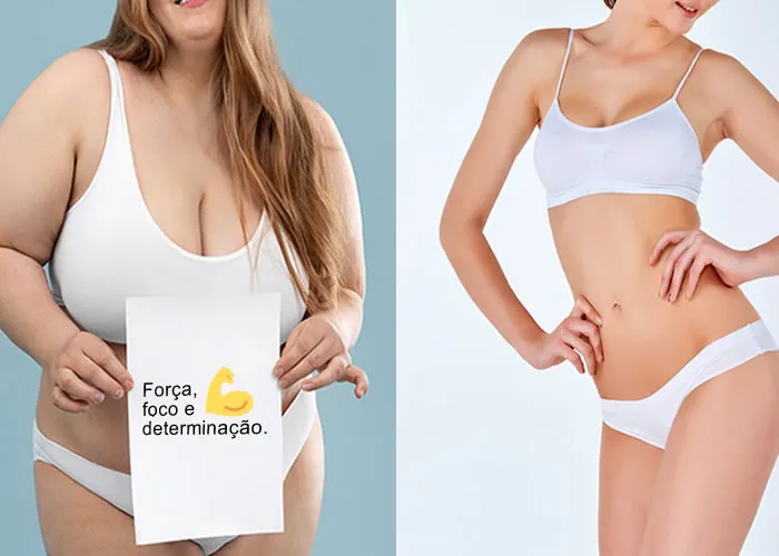 Muitas pessoas reclamam de suas protuberâncias na barriga. Elas estão cansados de passar horas na academia apenas para ter alguns centímetros removidos de sua cintura. 

A maioria das pessoas pensa que malhar não é suficiente para perder peso. Elas também se queixam da falta de acesso à informação nutricional de qualidade. Para ajudar a combater esses problemas, existem vários suplemento dietético para aliviar  barriga visando a gordura armazenada em seu abdômen.

A gordura da barriga é um tipo de tecido adiposo (gordura) que se acumula sob a pele devido a más escolhas alimentares ou ingestão excessiva de calorias. A gordura da barriga metabolicamente ativa gera excesso de calor e aparece como uma protuberância sob a pele. Está associado ao aumento do risco de doenças cardiovasculares, câncer, diabetes e outros problemas de saúde. A remoção dessa gordura é difícil, pois é armazenada em um estado inativo e requer ferramentas especializadas. No entanto, existem maneiras de reduzir a quantidade de gordura da barriga ativa que você carrega.

Uma maneira fácil de reduzir sua ingestão de gordura é fazer exercícios abdominais logo pela manhã. Isso vai começar bem o seu dia, ajudando você a suar o excesso de sal de sua comida e beber água. Seu corpo usará o fluido extra para absorver o sal, o que fará com que você se sinta mais enérgico e regular durante as pausas para o banheiro. 

Você também deve evitar ficar sentado por longos períodos de tempo, pois isso causa acúmulo excessivo de gás no trato digestivo que escapa pelo abdômen. Você também deve evitar comer alimentos gordurosos antes de dormir, pois isso aumentará a quantidade de gordura metabolicamente ativa na área do estômago. proteínas e calorias. 

Tudo o que eles precisam fazer é pegar um intervalo de tempo entre as refeições sem perturbar seu precioso descanso de beleza! A pesquisa mostrou que dormir entre as refeições  conhecido como descanso esquelético aumenta o metabolismo em até 80%. 

Esse aumento é causado por uma redução no fluxo sanguíneo enquanto você dorme que redireciona o sangue para seus órgãos e para longe de suas extremidades. Isso reduz a quantidade de glicose disponível para armazenamento nas células do seu corpo, tornando muito mais fácil para você acordar sentindo-se magra novamente após uma boa noite de sono.

Exercícios pela manhã ajuda você a queimar o excesso de calorias armazenadas em seu corpo na área abdominal, reduzindo os depósitos de gordura em torno de sua cintura.
 
 A única coisa que você precisa fazer é seguir a esses passos fáceis e em breve você poderá exibir aqueles abdominais de tanquinho ou uma barriguinha sex!
, Melhores suplementos, Cápsula seca barriga e Lipo Corpus, em, Brasil