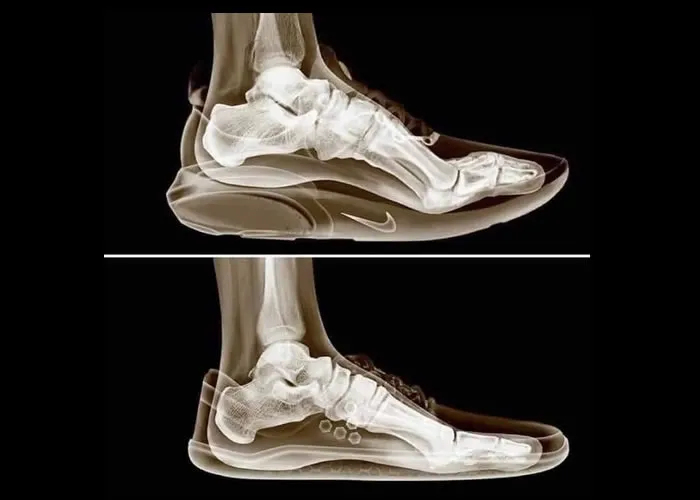Uma ilustração incrível do que a maioria dos sapatos modernos (muitos feitos pela Nike, Adidas, Ascis etc) fazem aos nossos pés em comparação com um sapato de estilo natural descalço.

A diferença mais notável está na posição dos dedos. A posição angular dos dedos no sapato superior é chamada de "mola do dedo do pé".

Se você olhar atentamente para muitos de seus sapatos (especialmente aqueles projetados para atletismo), o dedo do pé da frente subirá alguns graus.

Originalmente, esse recurso foi construído em sapatos grossos e inflexíveis como uma forma de ajudar a "rolar" o pé para frente enquanto caminhava. Pense nisso como ter o fundo de uma cadeira de balanço em seu pé.

Por que isso é um problema? A mola do dedo do pé basicamente força os dedos do pé a "encaixar". Seu pé foi projetado para ter todos os dedos completamente apoiados no chão quando você está suportando peso. Isso permite que os dedos dos pés se agarrem ao chão e forneçam estabilidade a todo o pé e, portanto, ao resto do corpo. Como 18 dos 19 tendões do pé estão presos aos dedos, permitindo que eles fiquem planos, essencialmente ancora todo o pé no chão e melhora a estabilidade (uma das razões pelas quais os dedos do pé saltam em um sapato de levantamento de peso ou qualquer calçado com sentido funcional ). você usa na academia faz absolutamente zero.

Então, se você atualmente usa um par de sapatos com biqueira flexível para a academia, eu recomendaria comprar um par de sapatos que permita que seus dedos fiquem apoiados no chão ou simplesmente ande descalço!!! !

É falado em um contexto ao realizar exercícios de força de pernas aplicados na academia (por exemplo, agachamento, levantamento terra, quadril, impulso de quadril, etc.),  Maior Loja Nike, Tecnologia adidas e Calçados promoção, em, Brasil