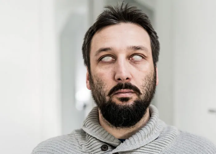 
Há algo real

Quando falamos de temas que envolvem lendas e religiões, é realmente difícil comprovar sua veracidade. Mas há algo real e perigoso, que tem grandes semelhanças com os zumbis.

Encefalite letárgica

Segundo Cummings, se os pacientes fossem estimulados, por exemplo, com tapinhas no ombro, aqueles que padeciam de encefalite letárgica sairiam de seu estado catatônico e ficariam "furiosos".


Somos fascinados por zumbis

O conceito morto-vivo fascina a humanidade. Nas últimas décadas, o sucesso de séries de TV, como The Walking Dead, ou filmes como Extermínio (28 Dias Depois, em Portugal) e Zumbilândia (Bem-vindo a Zombieland, em Portugal) são apenas uma prova disso.



Afinal, eles existem?

Mas qual seria a probabilidade real de hipotéticos zumbis causarem um apocalipse na Terra?



História dos zumbis

Antes de saber se são reais ou não, vamos conhecer melhor a história dos mortos-vivos. De acordo com History.com, a primeira civilização a preocupar-se com estes seres provavelmente foram os antigos gregos.



Descoberta de esqueletos humanos

Arqueólogos descobriram túmulos gregos antigos que continham esqueletos humanos enterrados com objetos pesados e rochas em cima. Acredita-se que isso poderia ser uma estratégia para manter os mortos presos ao subsolo.



A ideia moderna de zumbis

Mais tarde, nos séculos XVII e XVIII, o conceito "zumbi" começou a tomar a forma como a conhecemos hoje. De acordo com History.com, isto ocorreu pela primeira vez no Haití.


Escravos viam a morte como uma fuga

Naquela época, um grande número de pessoas da África foram levadas, pelos franceses, para Saint-Dominque, atual Haití. As terríveis condições a que eram submetidas fizeram com que acreditassem que, uma vez mortas, voltariam a viver livres no seu continente de origem.

, Simule seu Plano seguro, Plano Samel e Plano Nacional , em, Brasil