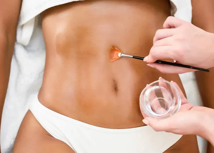 A gordura é armazenada nos tecidos e órgãos do corpo, o que contribui para o aparecimento de peso extra. A criolipólise, também conhecida como criolipólise, é uma técnica médica que congela a gordura indesejada. Lipoaspiração convencional e ultra-som são as técnicas mais comuns usadas para remover depósitos de gordura. No entanto, a criolipólise é menos intrusiva e pode resultar em perda de gordura mais rápida. A congelação como células desmontáveis, fazendo com que elas se libertam e liberam seus conteúdos.

O procedimento também pode promover a destruição de mioses lipídicas presentes no coração, pulmões e outros órgãos.

A diligência do procedimento varia de paciente para paciente. Em casos, o cirurgião vai usar um agulhamento para avaliar a condição do paciente antes de realizar o procedimento. Ele vai selecionar as localizações desejadas e realizar o procedimento em aparelho específico. 

Os pacientes sentirem uma sensação também de fragilidade após o procedimento. Isso é normal e passa em poucos minutos após a sua realização. Em seguida, os sintomas passam para algo assim: um alto nível de lancinante e uma sensação de estrangulamento no abdômen após alguns dias da cirugia. Essas reações são normais e decorrem da destruição das células mortas durante a criolipólise-gordura.

Como acontece com qualquer tratamento médico para perda de peso, a criolipólise pode ter alguns efeitos negativos, mas pode ser um maneira eficaz de perder peso com segurança e rapidez. Alguns pacientes apresentam hematomas, dor e outros efeitos colaterais, mas geralmente são menores quando comparados a outros métodos de cirurgia para perda de peso. Para obter mais informações sobre o procedimento ou agendar uma consulta em um centro qualificado perto de você, fale com seu médico hoje!
, Criolipólise advanced, Técnica Lipocavitação e Clinicas de harmonização, em, Brasil