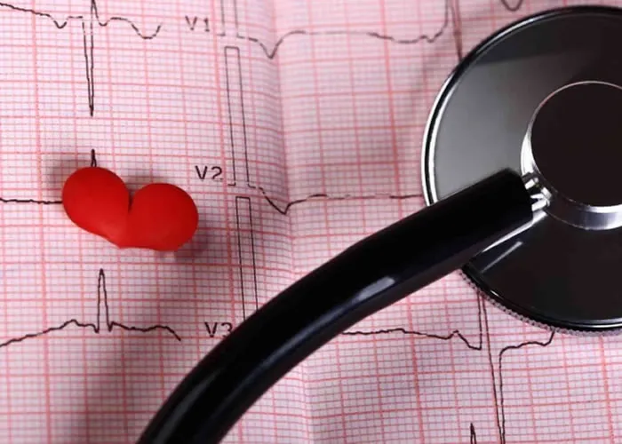 Ritmo cardíaco irregular, chamado de fibrilação atrial, deve ser tratado assim que descoberto pois aumenta em até cinco vezes as chances de desenvolver um avc isquêmico. 


A Fibrilação Atrial (FA) é a alteração do ritmo cardíaco mais frequente e sua presença está associada a um aumento do risco de AVCi (acidente vascular cerebral isquêmico) e a piora da função cardíaca. Perigosamente silenciosa, os sintomas mais comuns são evidenciados por aceleração de batimentos, tontura, desconforto ou dor no peito, desmaio, fadiga ou fraqueza, que acometem, na maioria das vezes, pessoas acima dos 60 anos. Estudos recentes, *Stop AF First, dos EUA, e o *EARLY-AF, do Canadá, ambos de 2020, testaram a terapia de crioablação como primeira opção de tratamento e comprovaram que a técnica foi superior ao tratamento medicamentoso. 


Segundo a Dra. Silvia Boghossian, eletrofisiológista da Universidade do Estado do Rio de Janeiro, os estudos mostraram que a doença tem maior chance de cura, quando tratada precocemente. 
 , Fibrilação Atrial, Medicina, Saúde e Beleza e Crioablação tratamento, em, Brasil
