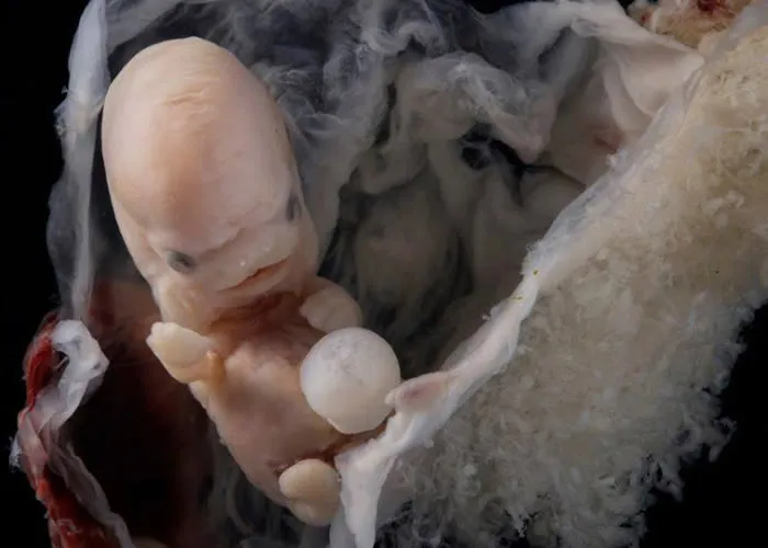 Este é um embrião humano de 6 semanas.

Nesta fase ocorrem os mecanismos de apoptose celular que vão dar origem à formação das falanges das mãos e hemisférios cerebrais., Fertilização artificial, Estude genética e Ciências Biológicas Ead, em, Brasil