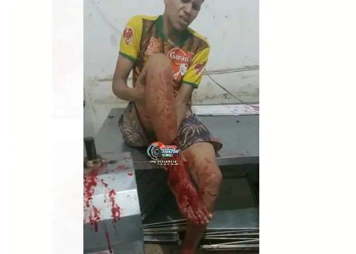 Ao desce pelo basculante da padaria o jovem pisou no interruptor que liga a máquina e ao descer com a outra pena a mesmo colocou dentro da amassadeira.

Jovem teve parte da tíbia dilacerada ao tentar furtar uma padaria, os padeiros quando chegaram encontraram o jovem com parte da perna dentro da máquina de amassar massa de pão.

, Vagas de caixa de padaria, Vagas auxiliar de panificação e Vagas para recepcionista, em, Brasil