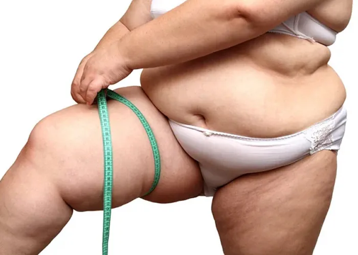 Manaus desponta como a segunda capital brasileira com maior porcentagem de pessoas obesas, de acordo com dados recentes do Ministério da Saúde.

Com mais de 60% dos brasileiros enfrentando excesso de peso em 2023, o cenário é preocupante e traz desafios para a saúde pública e para o Sistema Único de Saúde (SUS). , Obesidade, Saúde pública e Excesso de peso, em, Brasil