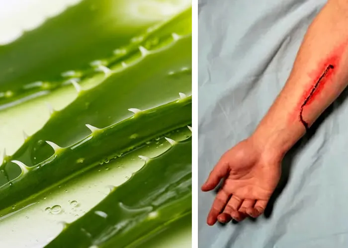 Aloe vera é uma planta incomum que produz gel com propriedades curativas. As pessoas em muitos países usam aloe vera para queimaduras, cortes e outras condições de pele. Em muitos casos, o aloe vera provou ser mais eficaz do que a medicina convencional. Seu gel tem inúmeras aplicações na área médica.

Os estudos disponíveis evidenciaram que produtos à base de Aloe vera aceleram o processo de cicatrização de feridas agudas e crônicas

Aloe vera é uma planta originária da África e da Ásia. Tem inúmeros usos na medicina tradicional de muitas culturas. As folhas, frutas e gel da planta têm propriedades medicinais. Os extratos de aloe vera são amplamente utilizados devido às suas propriedades medicinais. No Brasil, China, Índia e Índia, ainda  cozidas e gelatinizados como um chá delicioso para acalmar a mente e ajudar no sono. Muitas outras culturas usam aloe vera como uma lâmina e limpa a pele. 

, Creme contra envelhecimento, Rituais cuidados corporais e Remodela o rosto, em, Brasil