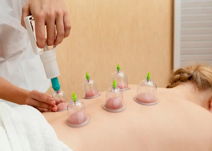 Gente, a ventosa corporal é um tipo de tratamento ótimo na estética e em fisioterapias, por exemplo. A pele é sugada por um copo, então precisa de técnica pra aplicar, viu? Com a ajuda de um profissional, você consegue resultados incríveis na circulação do sangue, diminuição da dor, redução de medidas, além de ser muito relaxante. Vem conhecer mais!

Como funciona a terapia com ventosa corporal

Pra começar, é bom saber que pra cada tratamento tem um jeito certo de usar a ventosa, tá?

Se for pra diminuir celulite, por exemplo, precisa passar um creme antes de colocar a ventosa no corpo. Isso vai ajudar o copo a deslizar e ativar a sucção da área que vai ser cuidada. 

O legal é que na estética corporal com ventosa, o corpo elimina toxinas, reduz a aparência das estrias e ainda melhora o funcionamento linfático, o que é ótimo pra desinchar o corpo com o líquido acumulado. Gostei!

Agora, não precisa fazer um bombeamento muito forte, é mais delicado do que os cuidados pra dor.

Ah, a ventosa suga a parte que vai ser tratada com a ajuda de um gatilho que encaixa no copo que vai na pele. Depois disso, dá pra bombear o gatilho pra puxar mais a pele que vai ficar sentindo uma pressão, mas não dói, viu?
Esse kit vem com manual, copos e gatilho. Tudo que precisa de uma vez só! 

Ventosa pra aliviar dores

Se o tratamento for pra dor nas costas, não é necessário passar creme. É só colocar os copos direto na pele, bombear pra ventosa sugar e esperar uns 10 minutos. 

Depois que tira a ventosa corporal, vão ter umas marcas roxas, dependendo do quanto a área tava dolorida e tensa. Não precisa se preocupar, depois a marca vai sair completamente, tá? 

Profissionais que fazem terapia com ventosa 

Sabia que qualquer profissional da área da saúde pode aplicar a ventosa? Pois é! É só estudar a técnica e se certificar. 

Então tem médico, fisioterapeuta, além de esteticista e massoterapeuta que tá habilitado pra trabalhar com esse procedimento, é só contar com alguém que seja da sua confiança, combinado?

Modelos e materiais de ventosa corporal

Gente, a ventosa costuma ser feita de acrílico, bambu, vidro e cerâmica. Os copos de acrílico são os mais usados. Isso porque é muito fácil de limpar e confortável pro paciente que recebe o tratamento. Além de ser prático pra quem tá fazendo o serviço, já que dá pra ver a pele sendo sugada e controlar bem o desempenho do copo.

Agora, falando de modelos de ventosa, tem no formato de bico de pato, ótimo pra lugares menores, como no rosto, por exemplo, servindo pra algum bem estético.

Alguns são ovais e outros cilíndricos, que são bons pra tratar o corpo com técnicas de acupuntura e fáceis de encontrar. Aí sim!

Com técnica de acupuntura, a ventosa pode ajudar a relaxar o corpo e a mente



, Kit ventosa, Estética e fisioterapia e Massagem relaxante, em, Brasil