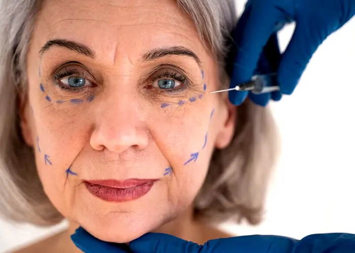 Harmonia Facial é um sistema revolucionário e completo de reequilíbrio da harmonia facial. O que foi conhecido por séculos como a "água da beleza" tem agora sido estudado de perto e provado funcionar por médicos e naturalistas. Seu rosto é rejuvenescido de volta até 10 anos.

Você já sonhou com um rosto mais fino, mais firme e sem idade? Você está procurando aquela solução permanente para seus problemas faciais sem gastar uma fortuna e suportar uma cirurgia dolorosa ou arriscar reações adversas a várias substâncias injetáveis? A mais recente tecnologia cosmética que é contorno facial é um procedimento não cirúrgico que faz você parecer mais jovem e mais bonito, removendo a gordura extra do rosto.

Quais os procedimentos da harmonização facial?

Alguns tipos de procedimentos: 

Toxina botulínica;
Lipo de papada;
Bichectomia;
Lifting facial;
Bioestimuladores de colágeno;    Microagulhamento;
Preenchimento do rosto;
Peeling;
Preenchimentos dentários.



Como as pessoas envelhecem, as características faciais tendem a mudar. Isto pode ter um impacto negativo em sua aparência geral.

O valor estimando de uma harmonização facial varia de R$ 800,00 a R$ 20.000 mais ou menos.

Obtenha os melhores resultados de contorno facial, sem a dor ou o tempo de inatividade de outros procedimentos.

Sua beleza é mais do que apenas a terapia de cuidado da pele para a alma, a terapia de harmonização facial leva você numa viagem além da superfície de sua pele para aqueles lugares onde seu corpo e coração querem ir.

A harmonização facial é um procedimento não cirúrgico que visa equilibrar suas características faciais, estimulando a produção de colágeno e melhorando a condição de sua pele e músculos faciais.


A Hameronização Facial faz parte dos tratamentos de beleza destinados a corrigir um grande número de "doenças" de pele sendo um procedimento cosmético minimamente invasivo., Técnicas microcirúrgicas, Cirurgia estética íntima e Curso estética facial, em, Brasil