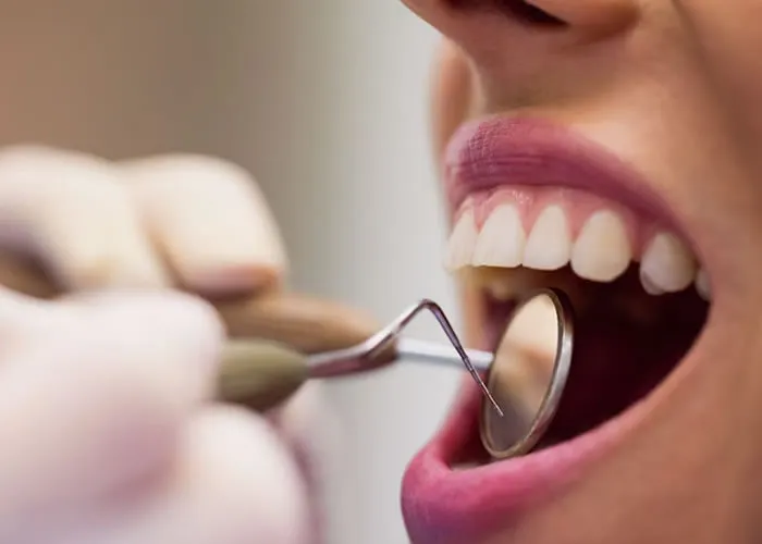 O Ministério da Saúde passou a financiar, por meio da Portaria Ministerial Nº 718/SAS de 20/12/2010, novos procedimentos da tabela do SUS

Aparelho ortodôntico/ortopédico e implante dentário osteointegrado (incluindo a prótese sobre o implante).

Para ofertar os serviços elencados, é necessário que o gestor municipal envie um ofício à Coordenação-Geral de Saúde Bucal, solicitando essa ação.

Para a especialidade da ortodontia e ortopedia, são oferecidos os procedimentos:

Procedimentos	Código
Instalação de aparelho ortodôntico/ortopédico fixo	03.07.04.011-9
Aparelho ortodôntico fixo	07.01.07.017-0
Aparelho ortopédico fixo	07.01.07.016-1
Para as especialidades de implantodontia e prótese, são oferecidos os procedimentos:

Procedimentos	Código
Implante dentário osteointegrado	04.14.02.042-1
Prótese dentária sobre implante	07.01.07.015-3
, Implante Dentário, Dentista 24 horas e Clínica odontológica, em, Brasil
